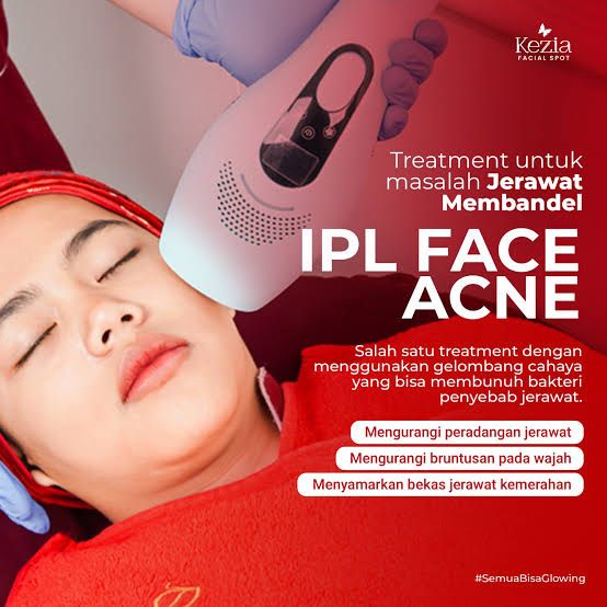 IPL face Acne + facial acne