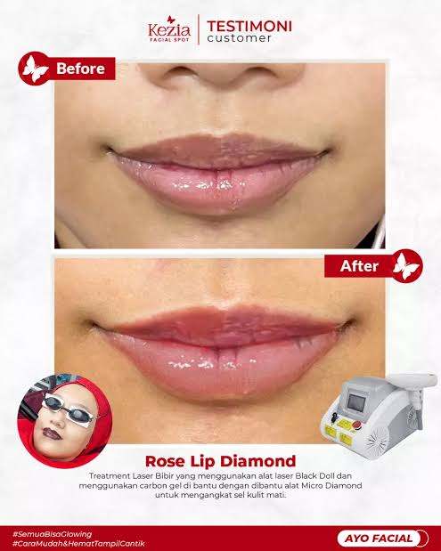 Rose lip diamond