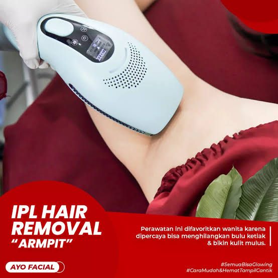 IPL hair removal armpit